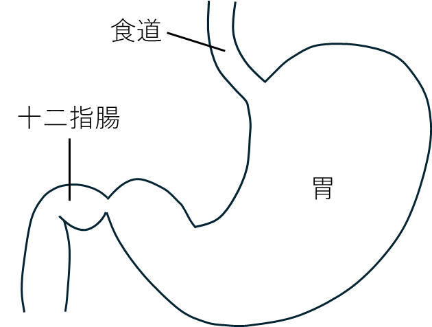 胃カメラ
